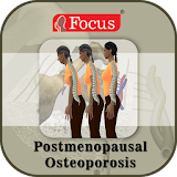 Postmenopausal Osteoporosis icon