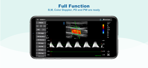 uREzpocus Screen 2