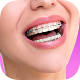 Top Design Braces teeth icon