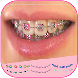 Braces Teeth Booth Pro 2017 icon