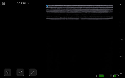 SC1App CE Screen 2