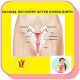 How to Recover your Vaginal size after Birth icon