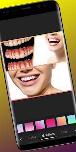 צילום מסך של מעצב שיניים