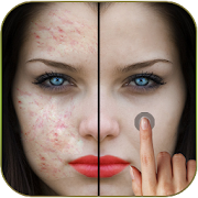 Pimples removing photo editing app 1.0 Icon