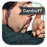 How To Get Rid Of Dandruff icon