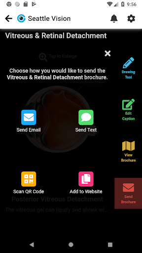 Eye GIFs - Patient Education Screen 3