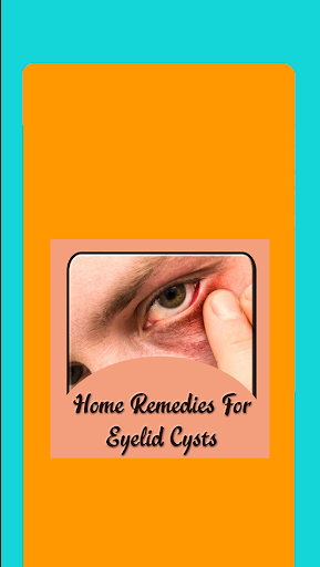 Remedies For Eyelid Cysts