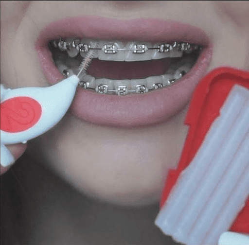 Android application Dental Braces screenshort