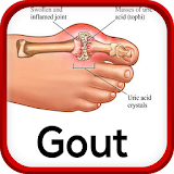 Gout Disease icon