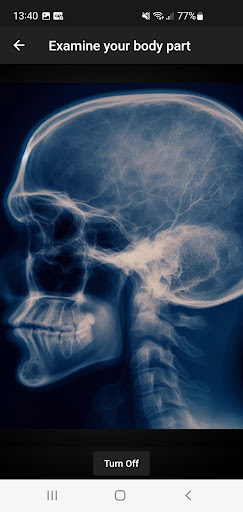 X-ray Scanner Screen 3