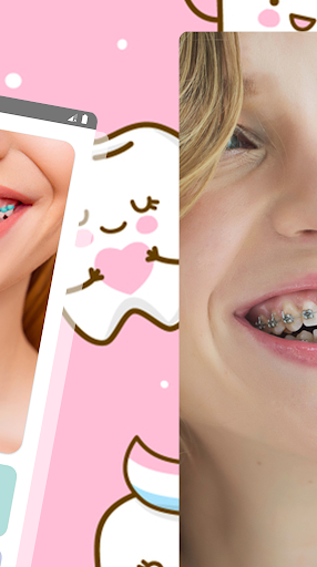 Braces Photo Editor Screen 2
