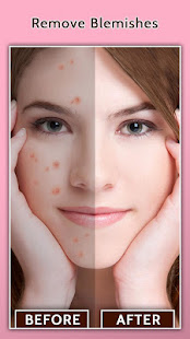 Face Blemish Remover - Smooth Skin & Beautify Face  Screenshots 13