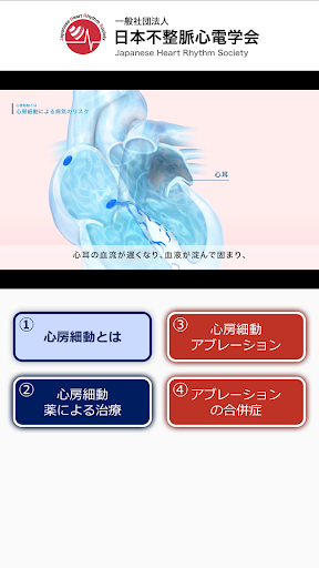 心房細動・カテーテルアブレーション解説動画 Screen 2