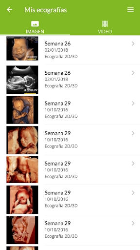 Mi embarazo en HURS Screen 3