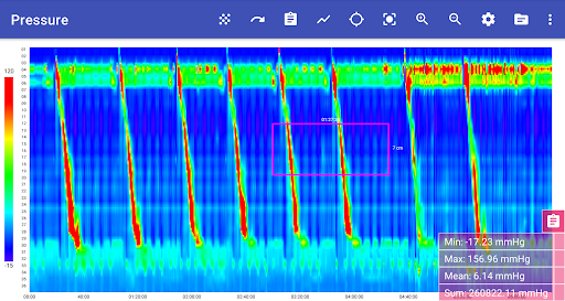 Dplots (lite) Screen 2