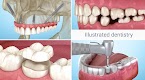screenshot of Dental 3D Illustrations