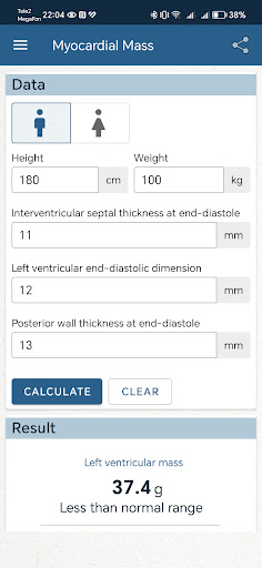 Miocardial Mass Screenshot 4 - AppWisp.com