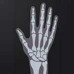 Cover Image of Baixar Aplicativo Bone Age 1.1.2 APK