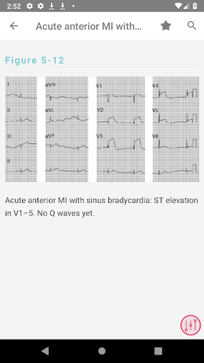 Swanton's Cardiology Guide 4