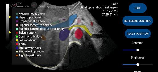 Android application Scanbooster Ultrasound Sim screenshort