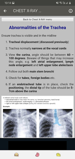 X-RAY Interpretation - cases Screenshot