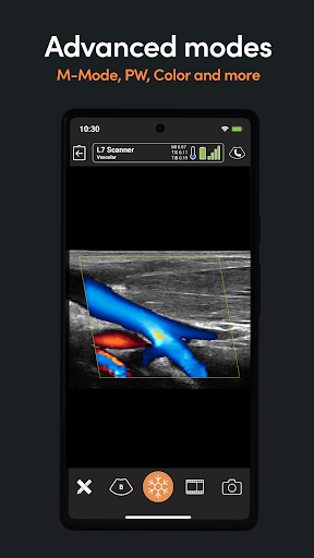 Clarius Ultrasound screenshot 8