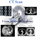 CT Scan Cross Sectional Anatomy Apk