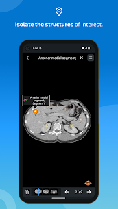 e-Anatomy MOD APK (Premium Unlocked) 4