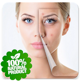 Skin Treatment - Get Rid Of Acne And Pimples Natur icon