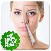 Skin Treatment - Get Rid Of Acne And Pimples Natur