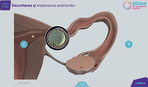 Atlas RA - MERCK Screen 2