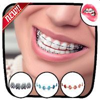 Braces Teeth  Photo Editor