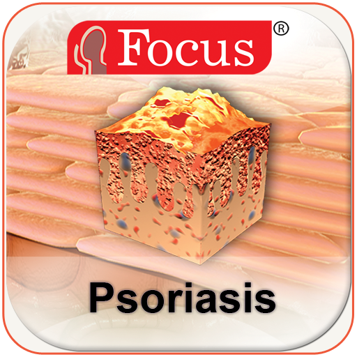 Psoriasis logo