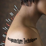 Acupuncture Techniques icon