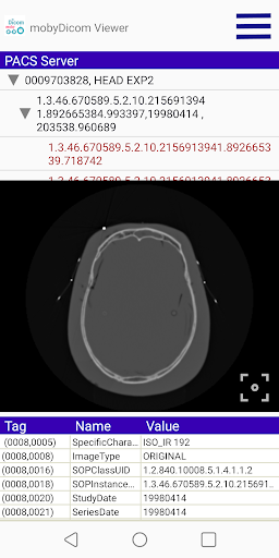 mobyDicom - DICOM Viewer Screen 3