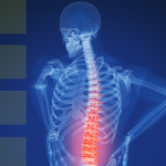 Back Pain & How To Prevent It Apk