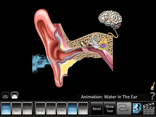 Ear Disorders - Outer Middle Screen 3