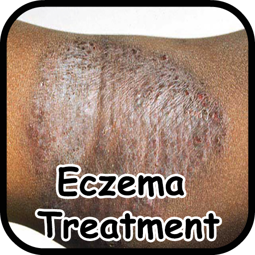 Eczema Symptoms Treatment  Icon