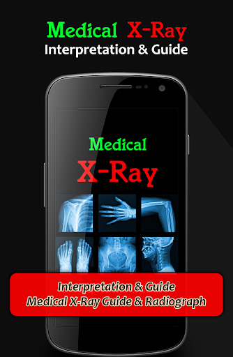 X-Ray Interpretation Guide 2
