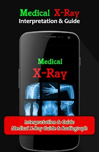 X-Ray Interpretation Guide