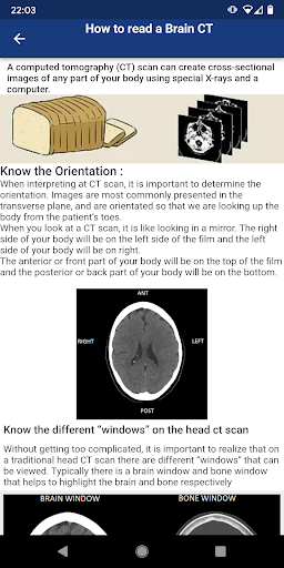 Brain CT : annotated slices Screen 2
