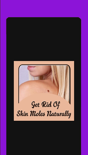 Get Rid of Skin Moles Naturall