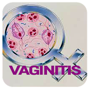 Vaginitis Disease