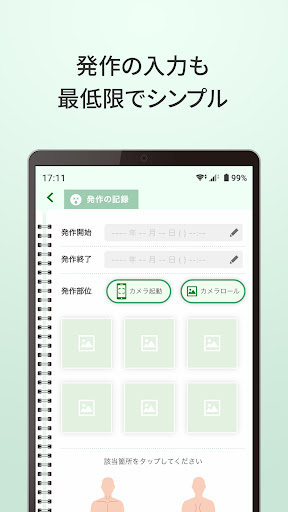 HAE日誌 Screen 3
