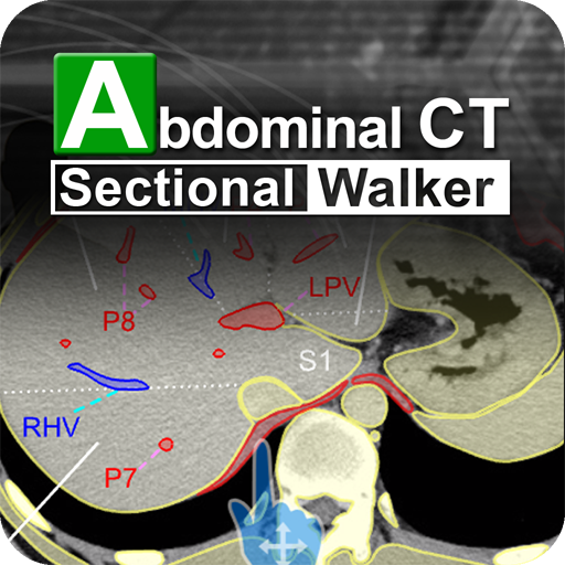 Abdominal CT Sectional Walker Latest Icon