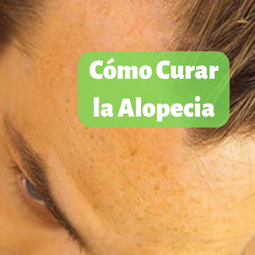 Cómo la Alopecia de - Aplicaciones en Google Play