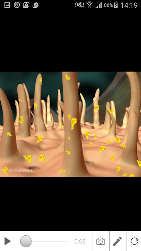 Atherosclerosis Screen 3