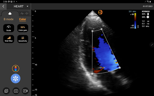 Kosmos Ultrasound Screen 3