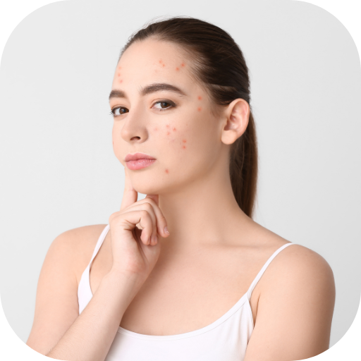 acne treatment for teens Download on Windows