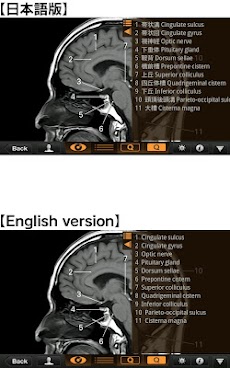CT・MRI解体新書のおすすめ画像3